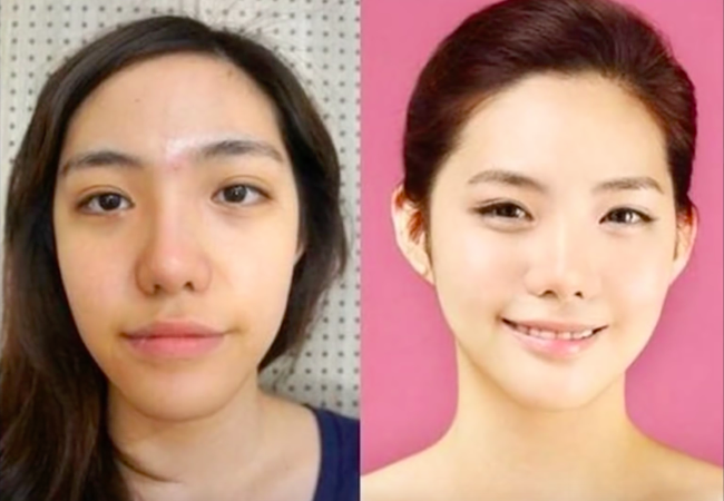 Con g&aacute;i v&agrave; những pha lột x&aacute;c ngoạn mục nhờ phẫu thuật thẩm mỹ! - Ảnh 15.
