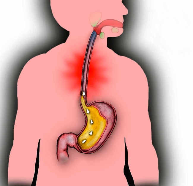 Cứ ngủ ngay sau khi ăn trưa, cẩn thận kẻo mắc c&aacute;c bệnh nguy hiểm n&agrave;y - Ảnh 2.