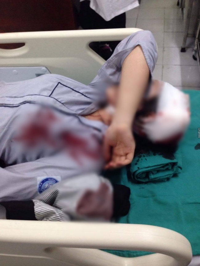 Nữ sinh lớp 10 ở Hà Nội bị bạn học đánh chấn thương sau giờ tan trường - Ảnh 1.