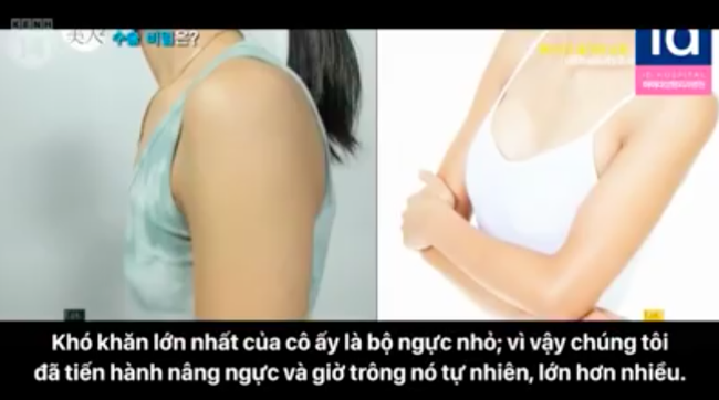 Con khóc thét vì không thể nhận ra mẹ sau phẫu thuật thẩm mỹ - Ảnh 2.