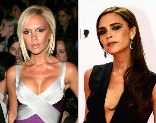 Victoria Beckham thừa nhận bơm ngực vì mặc cảm vòng 1 nhỏ và giờ đã hối hận - Ảnh 4.