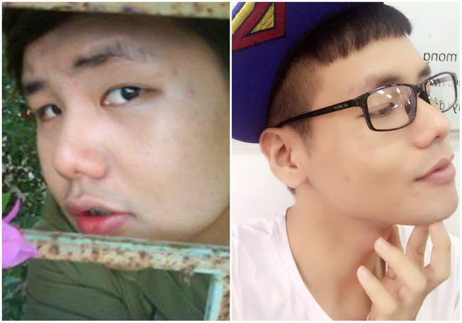 Bị nghi ngờ phẫu thuật thẩm mỹ, Đức Anh Hugo tự tin tung ảnh thời xưa đ&aacute;p trả - Ảnh 9.