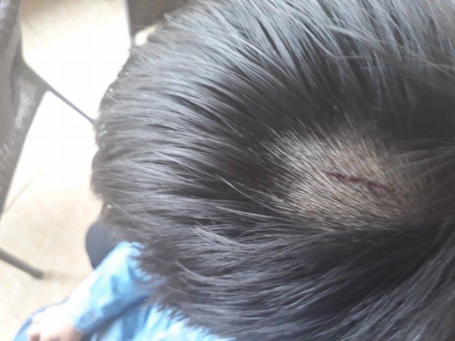 Lời trần t&igrave;nh của c&ocirc; gi&aacute;o d&ugrave;ng thước đ&aacute;nh v&agrave;o đầu 25 học sinh tiểu học ở Nghệ An - Ảnh 2.