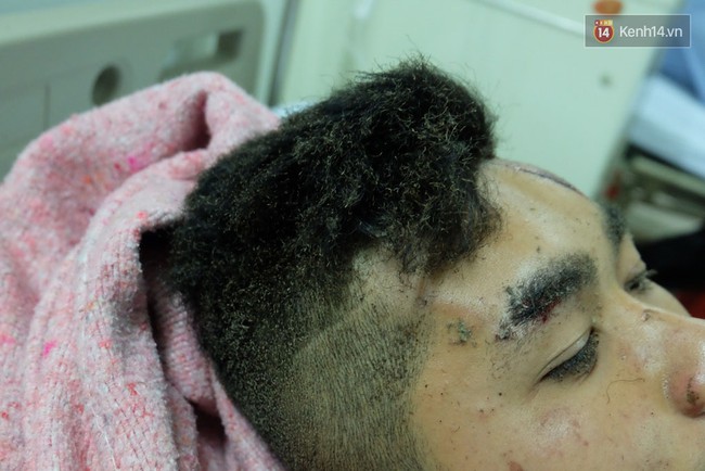 Nam thanh ni&ecirc;n sống s&oacute;t sau vụ nổ tr&ecirc;n xe kh&aacute;ch: &ldquo;T&ocirc;i thấy c&oacute; h&agrave;nh kh&aacute;ch bị văng ra ngo&agrave;i, cơ thể kh&ocirc;ng nguy&ecirc;n vẹn&rdquo; - Ảnh 6.