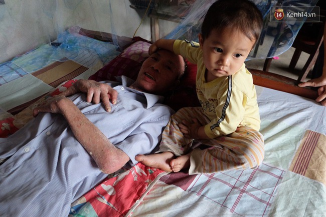 Cuộc sống khốn kh&oacute; của người chồng liệt giường suốt 2 năm, từng muốn chết để vợ con bớt khổ - Ảnh 8.