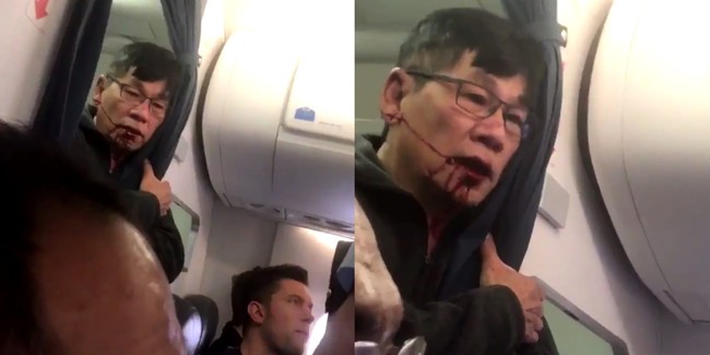 Những bê bối ẩn giấu phía sau vụ hãng hàng không lớn thứ 2 thế giới đối xử thô bạo với hành khách - Ảnh 5.
