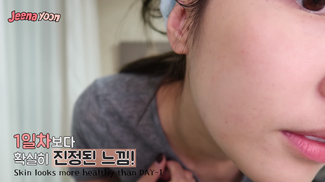 Tại sao da g&aacute;i H&agrave;n lu&ocirc;n căng b&oacute;ng, mịn m&agrave;ng kh&ocirc;ng t&igrave; vết? Trị liệu da c&aacute; hồi ch&iacute;nh l&agrave; c&acirc;u trả lời - Ảnh 16.