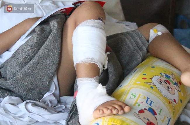 B&eacute; g&aacute;i 8 tuổi bị cụt tay sau tai nạn ng&agrave;y m&ugrave;ng 4 Tết: &ldquo;Ba ơi! Sao tay tr&aacute;i con ngắn hơn tay phải?!&rdquo; - Ảnh 6.