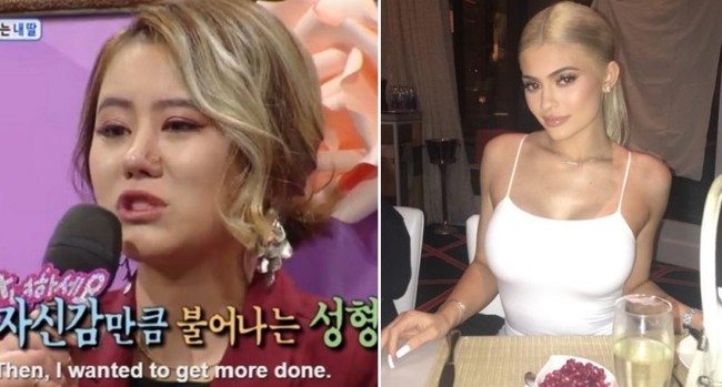 Nữ sinh Hàn Quốc phẫu thuật thẩm mỹ để có nét đẹp đậm chất tây như Kylie Jenner - Ảnh 3.