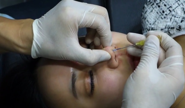 Trước khi quyết định phẫu thuật thẩm mỹ, nhất định phải đọc kỹ những điều n&agrave;y - Ảnh 2.