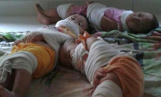 H&igrave;nh ảnh 3 đứa trẻ bị tr&oacute;i ch&acirc;n tay, bịt miệng tại trường mầm non g&acirc;y phẫn nộ - Ảnh 1.