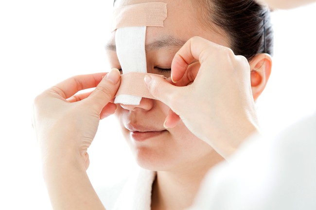 Trước khi quyết định phẫu thuật thẩm mỹ, nhất định phải đọc kỹ những điều n&agrave;y - Ảnh 3.