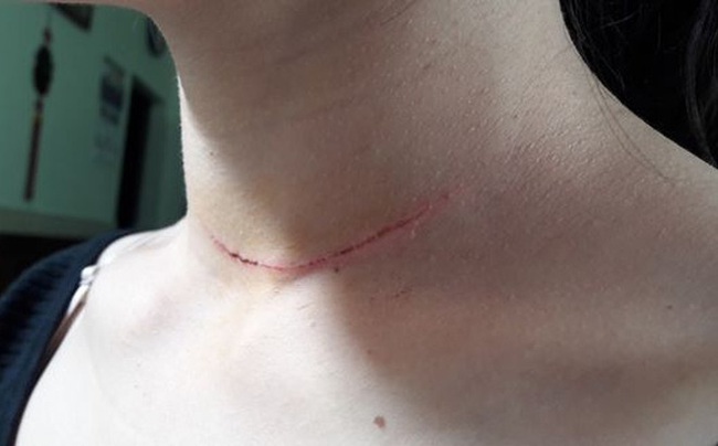 Đang đứng mời kh&aacute;ch, c&ocirc; g&aacute;i trẻ bị 3 kẻ lạ mặt r&uacute;t dao ch&eacute;m tr&uacute;ng cổ - Ảnh 1.