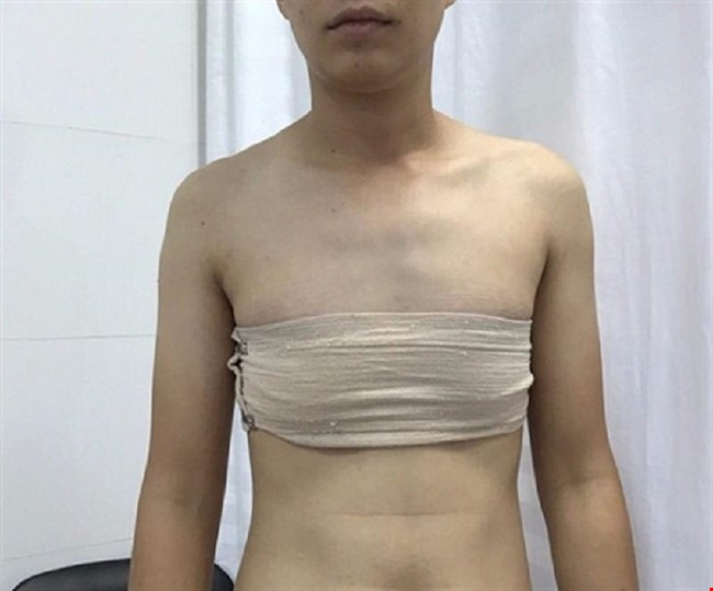 Sắp tiến h&agrave;nh ca phẫu thuật chuyển giới đầu ti&ecirc;n tại VN - Ảnh 1.