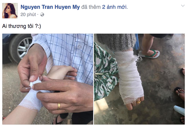 Á hậu Huyền My gặp chấn thương khi quay hình tại Myanmar - Ảnh 1.