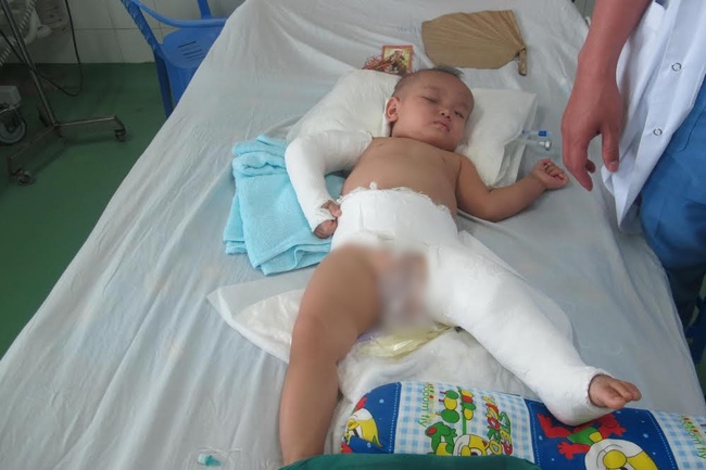 Cứu sống b&eacute; trai 15 th&aacute;ng tuổi rơi từ tầng 5 chung cư xuống đất - Ảnh 1.
