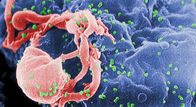 Phương thuốc điều trị tận gốc HIV đang đến rất gần - Ảnh 2.