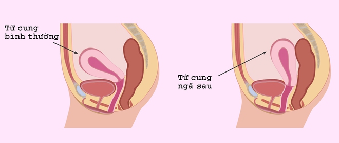 Đừng xem thường các chứng đau lưng bởi có khả năng bạn bị mắc các bệnh rất phổ biến - Ảnh 1.