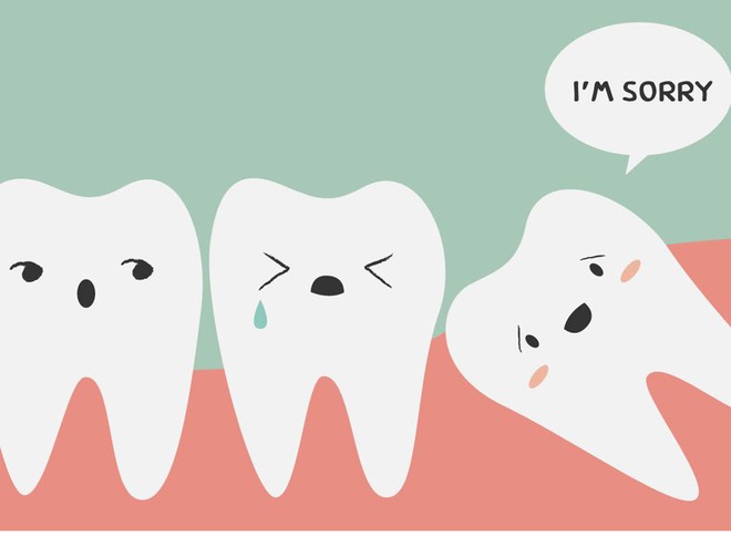 T&igrave;m hiểu c&aacute;c triệu chứng khi mọc răng kh&ocirc;n để c&oacute; c&aacute;ch đối ph&oacute; tốt hơn - Ảnh 3.