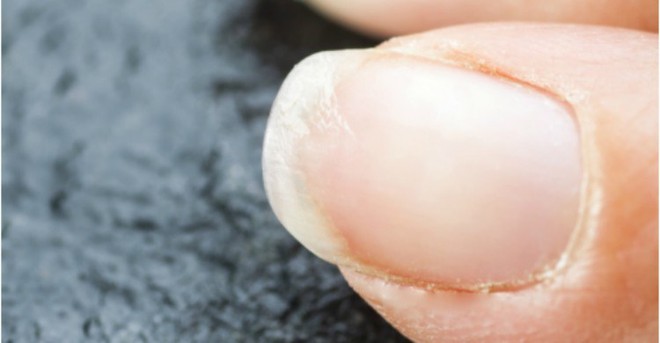 6 dấu hiệu thiếu sắt dễ nhận biết m&agrave; con g&aacute;i kh&ocirc;ng n&ecirc;n bỏ qua - Ảnh 1.