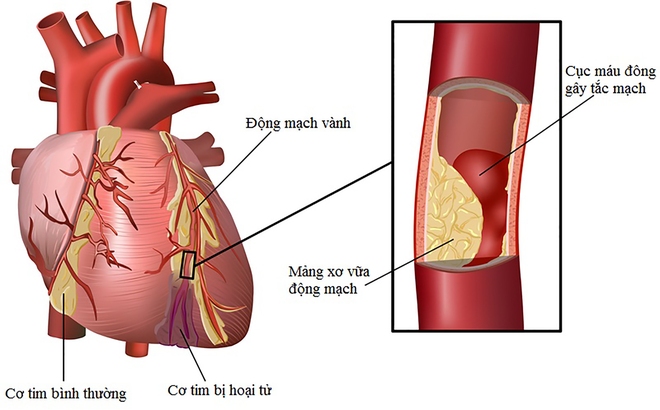 Khi thức khuya, rất nhiều người mắc thêm thói xấu này khiến sức khỏe bị tàn phá nghiêm trọng hơn - Ảnh 4.