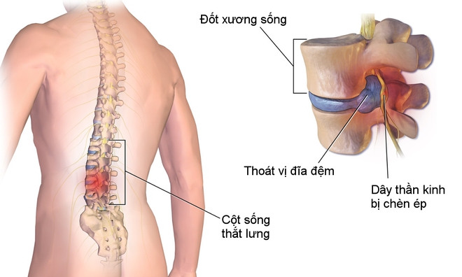 Ngồi máy tính cả ngày phải biết 5 điều này để sức khỏe không bị tổn hại nghiêm trọng - Ảnh 2.