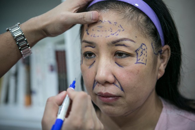 Trung Quốc: Trốn nợ thẻ t&iacute;n dụng 120 tỷ, người phụ nữ đi phẫu thuật thẩm mỹ  để kh&ocirc;ng ai biết mặt - Ảnh 1.