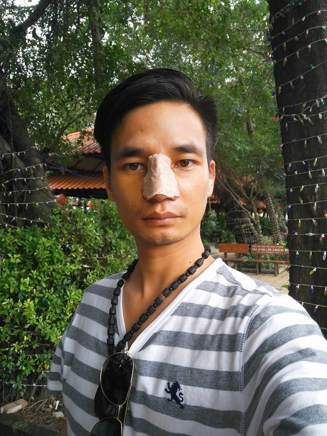 Những h&igrave;nh ảnh mới nhất của Lệ Rơi sau phẫu thuật thẩm mỹ - Ảnh 1.