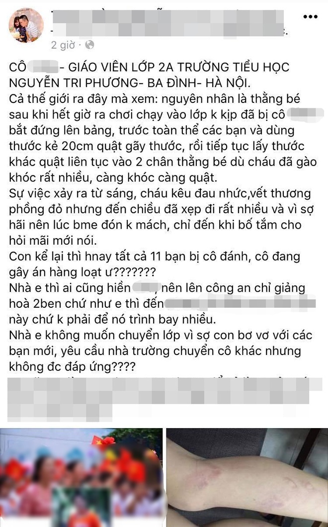 Hà Nội: Học sinh lớp 2 bị cô giáo đánh gãy thước, thâm tím hai chân do vào lớp muộn sau giờ ra chơi - Ảnh 1.