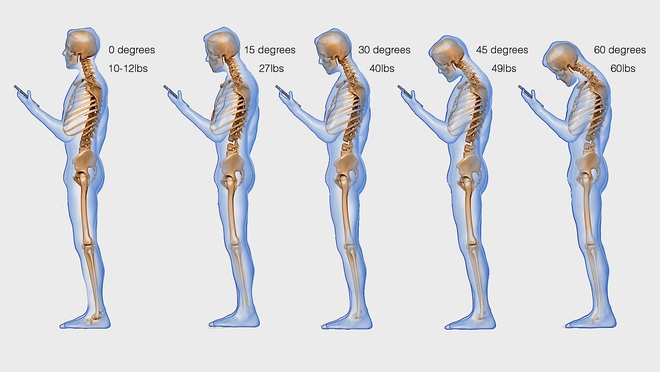 Chưa già mà đã hỏng cột sống là do 5 thói quen đang ngày càng phổ biến này - Ảnh 2.