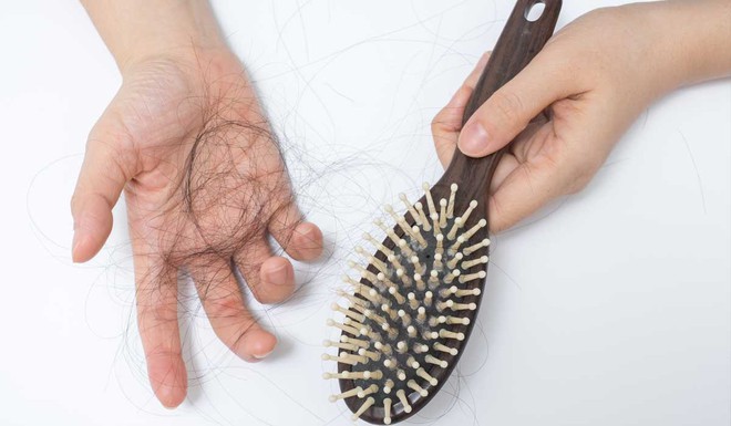 Phân biệt tóc rụng sinh lý và tóc rụng bệnh lý để biết lúc nào cần đi khám ngay - Ảnh 3.