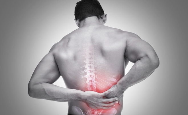 Đừng xem thường các chứng đau lưng bởi có khả năng bạn bị mắc các bệnh rất phổ biến - Ảnh 2.