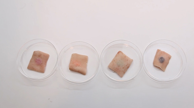 H&igrave;nh xăm chất chơi tự đổi m&agrave;u theo chỉ số đường trong m&aacute;u - Ảnh 4.