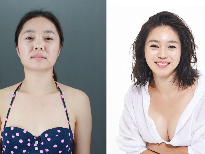 Người nước ngo&agrave;i đổ x&ocirc; đến H&agrave;n Quốc để phẫu thuật thẩm mỹ c&ograve;n nhiều hơn d&acirc;n bản địa - Ảnh 4.
