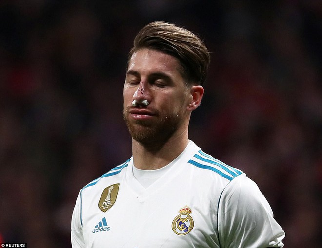 Đội trưởng Ramos vỡ mũi trong trận derby thành Madrid - Ảnh 5.