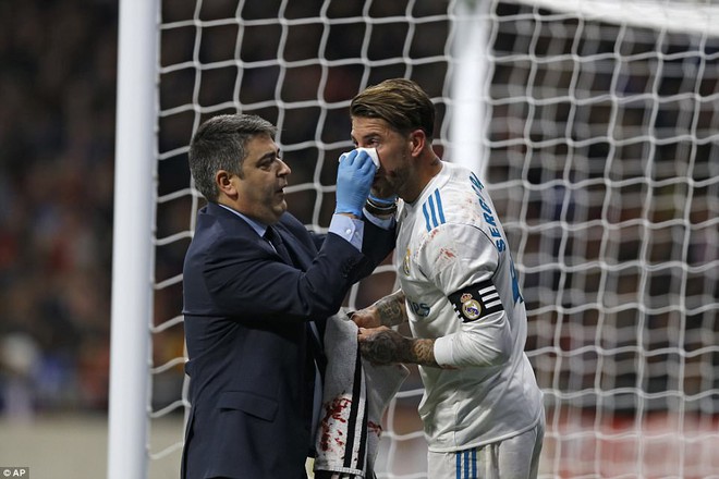 Đội trưởng Ramos vỡ mũi trong trận derby thành Madrid - Ảnh 4.