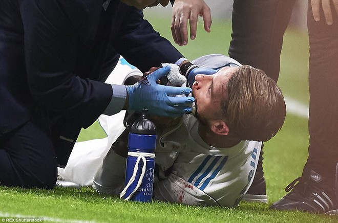 Đội trưởng Ramos vỡ mũi trong trận derby thành Madrid - Ảnh 3.