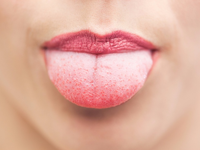 6 dấu hiệu thiếu sắt dễ nhận biết m&agrave; con g&aacute;i kh&ocirc;ng n&ecirc;n bỏ qua - Ảnh 4.