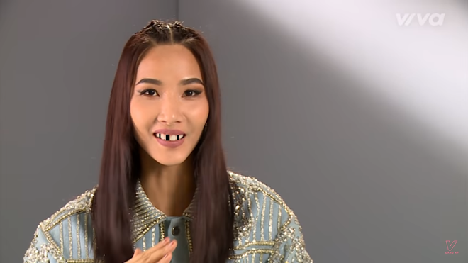 Trai xinh, g&aacute;i đẹp showbiz Việt sẽ ra sao nếu một ng&agrave;y bất ngờ&hellip; s&uacute;n răng? - Ảnh 14.