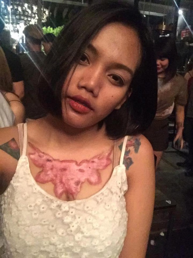 Xóa hình xăm hoa hồng khủng trên ngực, nữ sinh viên Thái Lan phải nhận cái kết đau đớn - Ảnh 1.