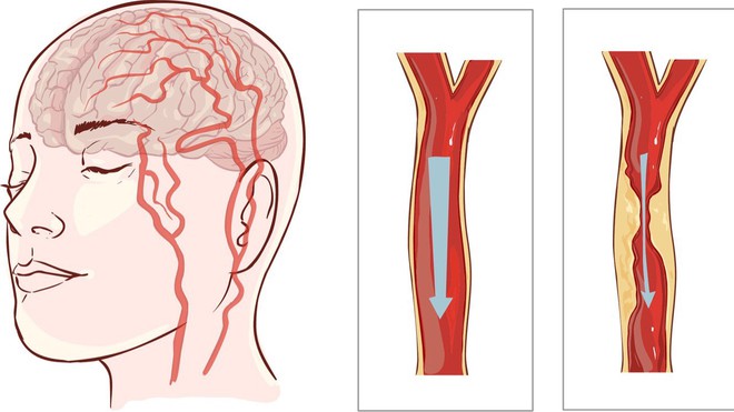 Ăn quýt để có được thật nhiều lợi ích, bao gồm cả giảm cân, giữ dáng - Ảnh 5.