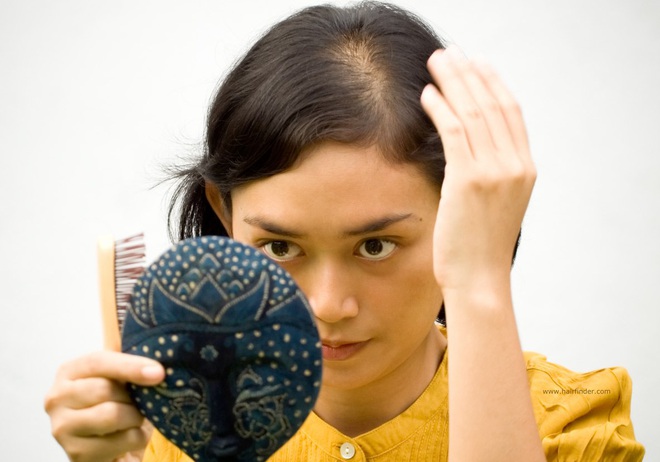 Phân biệt tóc rụng sinh lý và tóc rụng bệnh lý để biết lúc nào cần đi khám ngay - Ảnh 2.