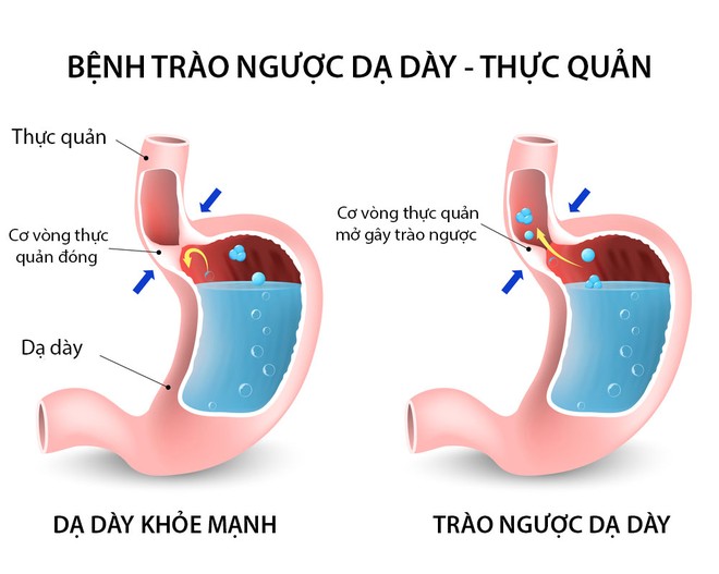 Khi thức khuya, rất nhiều người mắc thêm thói xấu này khiến sức khỏe bị tàn phá nghiêm trọng hơn - Ảnh 3.