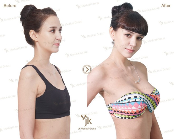 Người nước ngo&agrave;i đổ x&ocirc; đến H&agrave;n Quốc để phẫu thuật thẩm mỹ c&ograve;n nhiều hơn d&acirc;n bản địa - Ảnh 9.