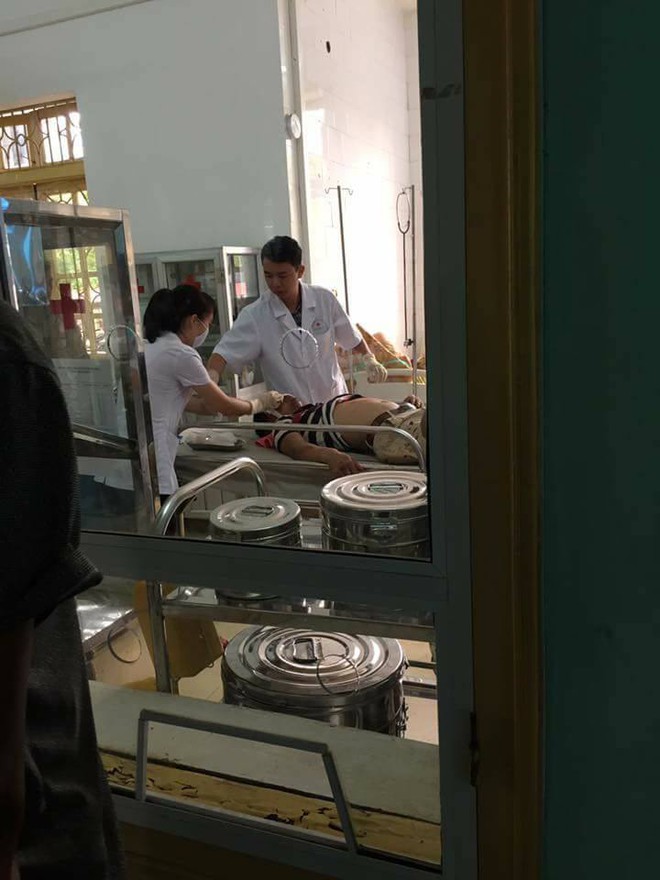 Y&ecirc;n B&aacute;i: Người đ&agrave;n &ocirc;ng cầm gạch n&eacute;m vỡ k&iacute;nh &ocirc; t&ocirc; khiến 1 người bị thương nặng - Ảnh 2.