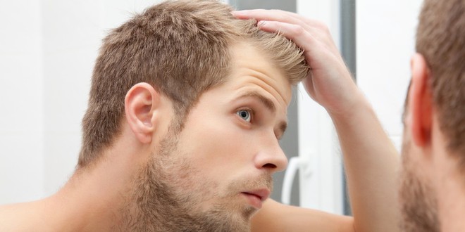 Loại hormone được tình nghi là thủ phạm gây nên chứng hói đầu ở nam giới là gì? - Ảnh 2.