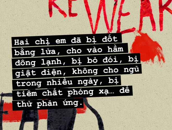 Chấn động lịch sử ngành y: Bí mật cặp song sinh dính liền bị bắt cóc để thực hiện những thí nghiệm tàn độc - Ảnh 3.