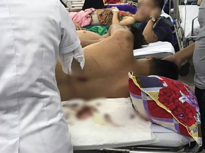 H&agrave; Tĩnh: Truy t&igrave;m nh&oacute;m c&ocirc;n đồ x&ocirc;ng v&agrave;o qu&aacute;n ăn ch&eacute;m loạn xạ khiến một nam thanh ni&ecirc;n phải nhập viện cấp cứu - Ảnh 1.