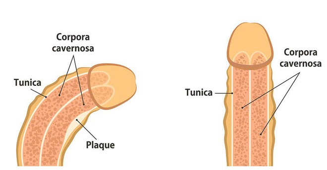 Mọi quý ông trên thế giới sẽ phải giật mình nhìn xuống dưới vì nghiên cứu đáng sợ này - Ảnh 2.