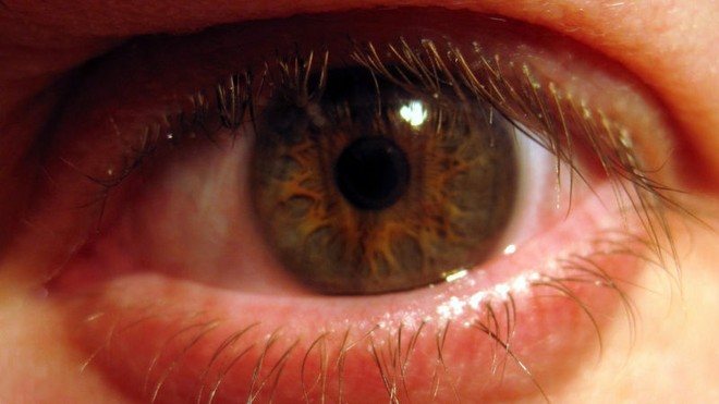 Phát hiện sốc: Trong mắt tồn tại 1 cộng đồng vi khuẩn - Ảnh 3.